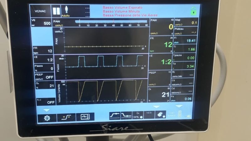 CORONA VIRUS DUE VENTILATORI POLMONARI PER LA TERAPIA INTENSIVA OSPEDALE DI BERGAMO parte amministrativa CORONA VIRUS DUE VENTILATORI POLMONARI PER LA TERAPIA INTENSIVA OSPEDALE DI BERGAMO parte amministrativa